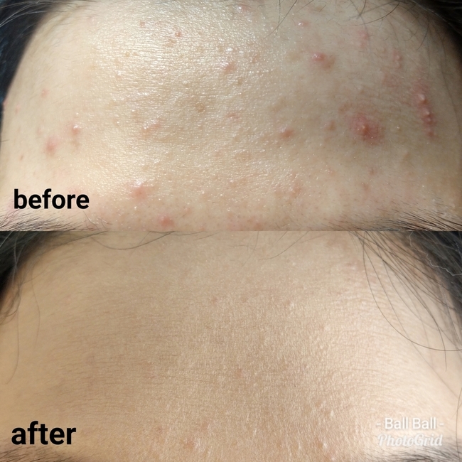 Kiweqq Dr Wu 達爾膚 杏仁酸溫和煥膚精華